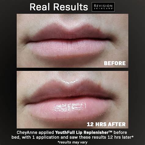 youthfull lip replenisher.